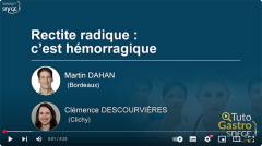 TutoGastro-SNFGE_Rectite radique-c’est hémorragique_2025 (copyright SNFGE).png