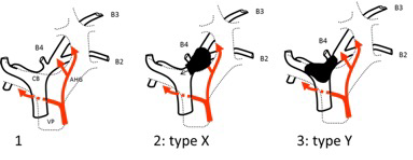 Figures 2 et 3